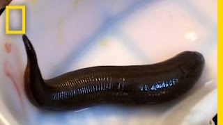 Leeches Cure  National Geographic [upl. by Hassett687]