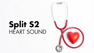 Fixed Split S2  Heart Sounds  MEDZCOOL [upl. by Lhary]