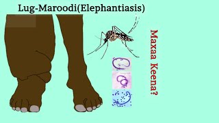 Maxaa keena xanuunka LugMaroodiga Elephantiasis [upl. by Dahcir]