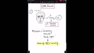 Basic Eye Anatomy and Physiology [upl. by Gib]