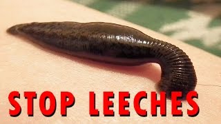 How to stop Leeches [upl. by Larissa]