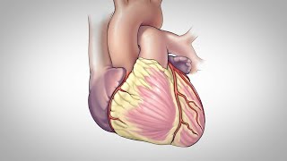 Heart Bypass Surgery CABG [upl. by Nabetse]