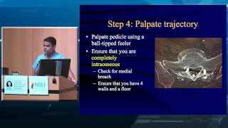 Lumbar Pedicle Screw Placement [upl. by Nawk]