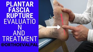 Plantar Fasciitis Post Tibial Block and PRP Injections [upl. by Osbert878]