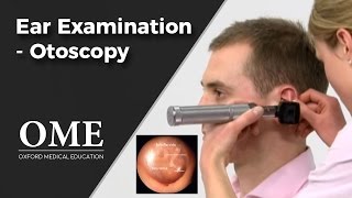 Otoscopy Ear Examination  ENT [upl. by Ivets]