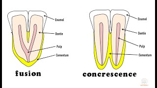 Developmental disturbances in shape of teeth  Part 1 [upl. by Kaliski]