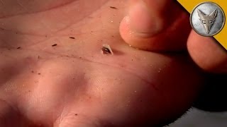 GROSS Baby Leech Burrows Into Coyotes Hand [upl. by Hull]