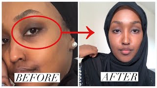 BYE 👋 les cernes amp les imperfections — MY SKINCARE ROUTINE [upl. by Eaton519]