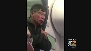 United Settles With Dr David Dao [upl. by Ahtela243]