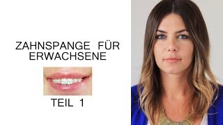 Zahnspange für Erwachsene  Der erste Schritt [upl. by Ataliah872]