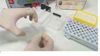 Hemoglobin electrophoresis procedure [upl. by Llezo]