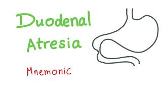 Duodenal Atresia Mnemonic [upl. by Neiviv736]