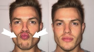 3 Exercises To Lose CHUBBY Cheeks Get a Defined Face [upl. by Nyliram]