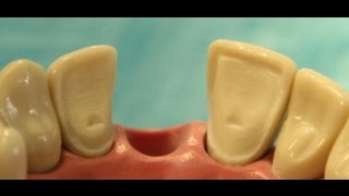 What Type of Procedures Do Periodontists Perform [upl. by Essirehc]