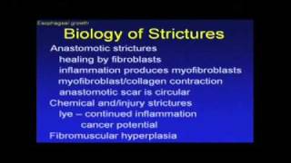 Tricuspid atresia  Circulatory System and Disease  NCLEXRN  Khan Academy [upl. by Neddy]