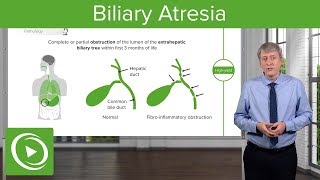 Biliary Atresia – Pediatrics  Lecturio [upl. by Ahsial]