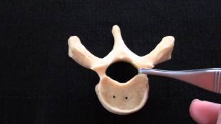 Typical Vertebra  Spinal column  Anatomy [upl. by Taam]