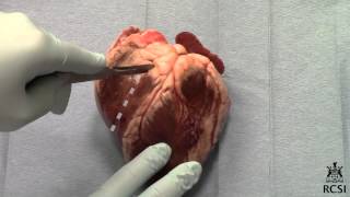 Sheeps Heart Dissection [upl. by Erica]