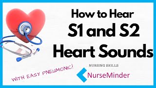 How to Hear S1 and S2 Heart Sounds [upl. by Nie500]