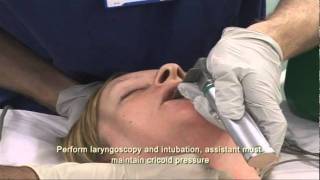 Intubation Extubation 37 [upl. by Callum]