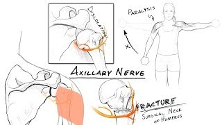 The Brachial Plexus II Animated Review HD [upl. by Ahseit]