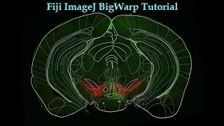 BigWarp  Overlay Brain Atlas Image on Brain Slice Image  FijiImageJ [upl. by Kcirdla]