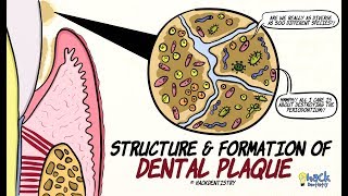 Dental Plaque Structure and Formation [upl. by Georgeanne]