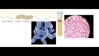 Campylobacter jejuni Part 1 Introduction Biochemical Properties and Virulence factors [upl. by Inanak581]